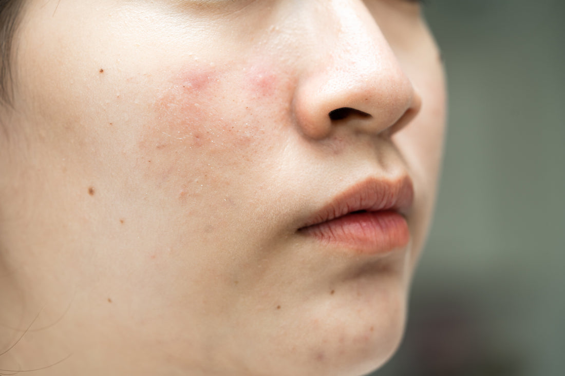 When Furnace Season Meets Sensitive Skin: A Gentler Fall Exfoliation Routine