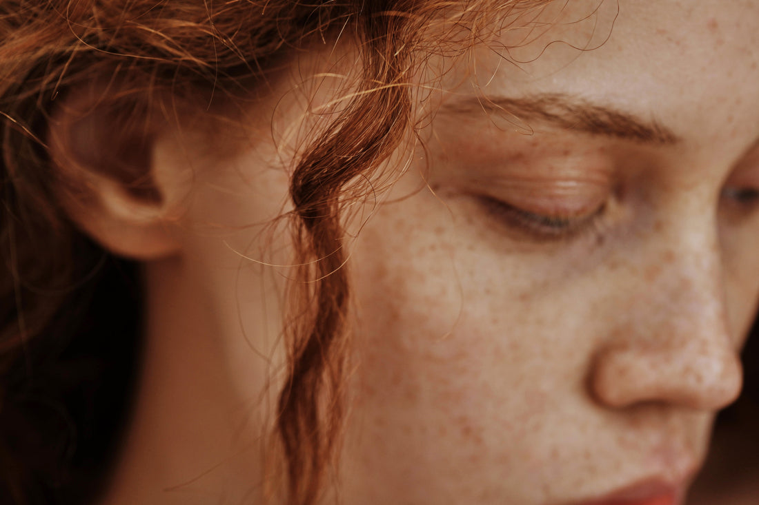 Why Your Skin Feels Worse in Spring And How to Fix It