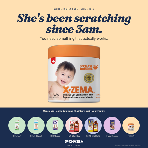 D'Chase X-Zema balm advertisement with a child's face on the packaging.